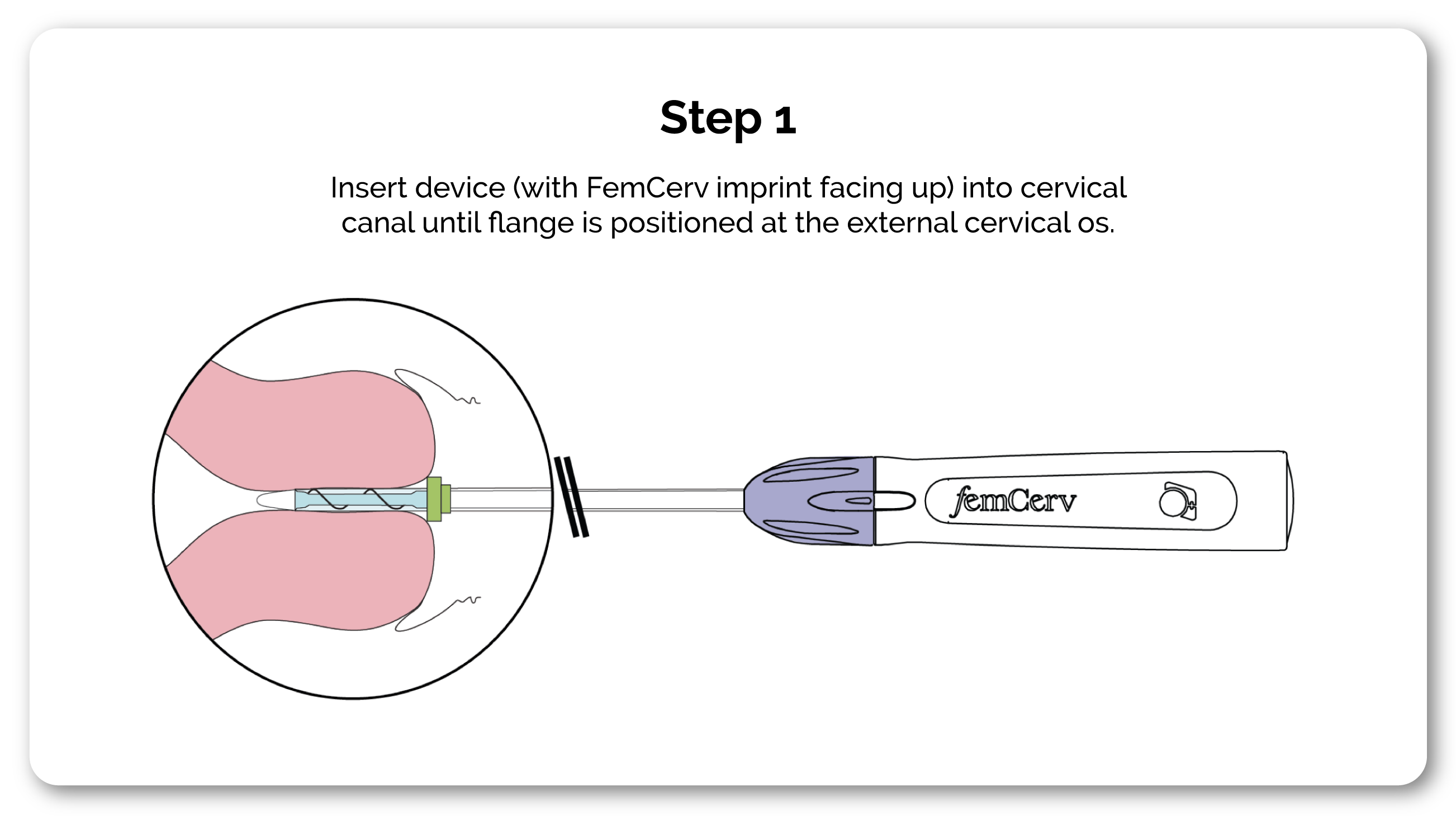 1-How-it-Works