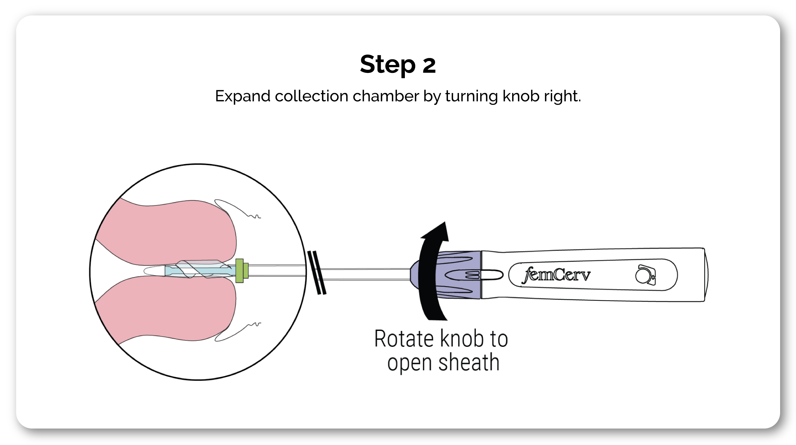 2-How-it-Works