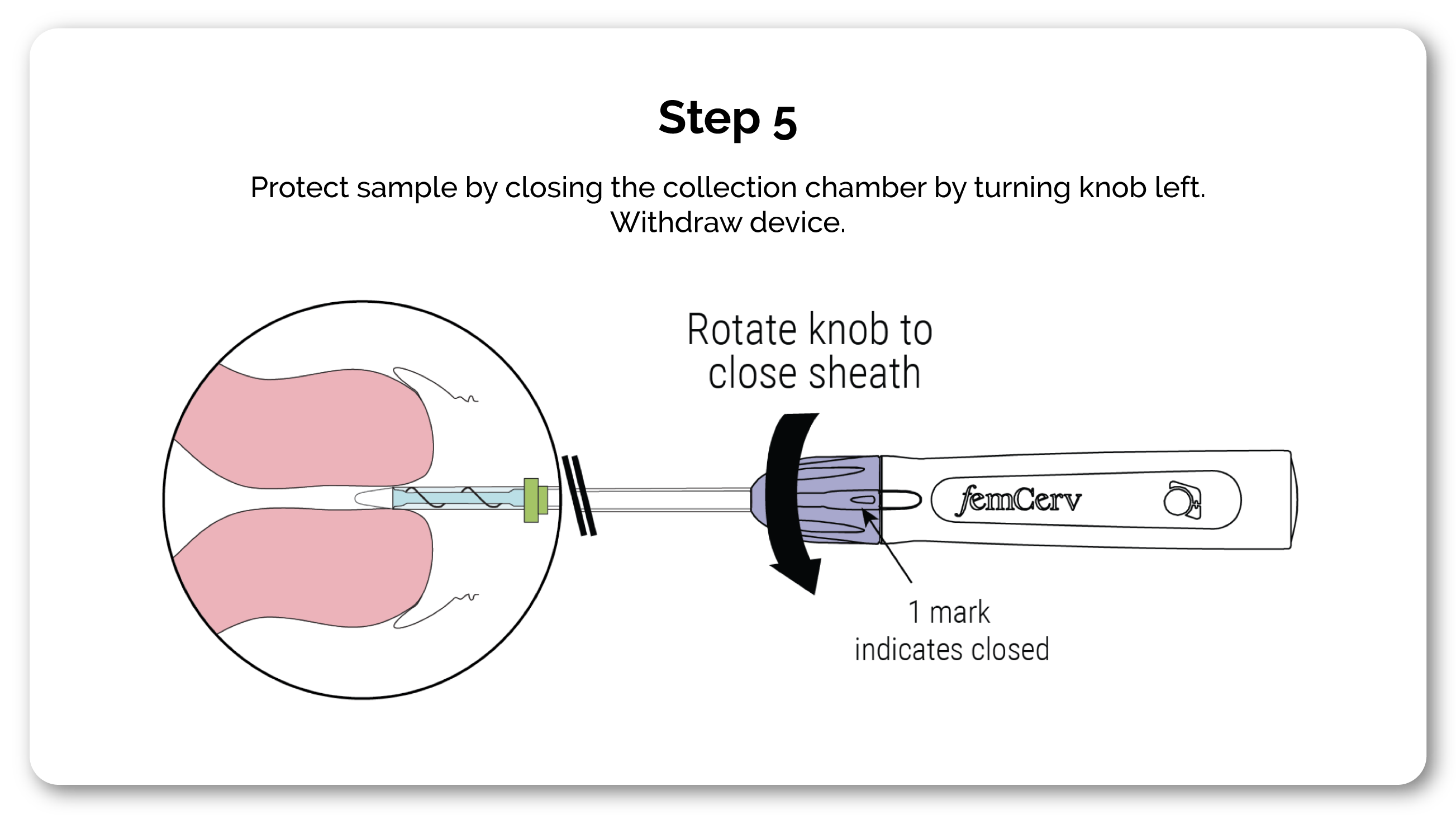 5-How-it-Works